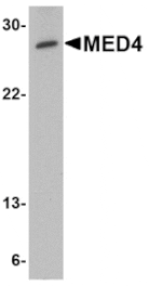 Western blot - MED4 Antibody from Signalway Antibody (24727) - Antibodies.com
