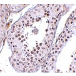Immunohistochemistry - MED4 Antibody from Signalway Antibody (24727) - Antibodies.com