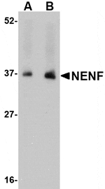 Western blot analysis of NENF in human kidney tissue lysate with NENF antibody at (A) 1 and (B) 2 µg/mL.