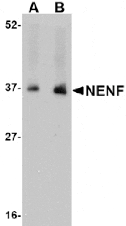 Western blot - NENF Antibody from Signalway Antibody (24736) - Antibodies.com