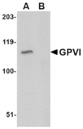 Western blot - GPVI Antibody from Signalway Antibody (24742) - Antibodies.com