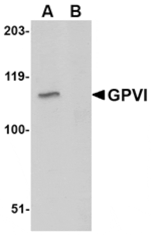 Western blot - GPVI Antibody from Signalway Antibody (24742) - Antibodies.com