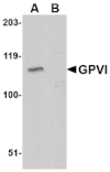 Western blot - GPVI Antibody from Signalway Antibody (24742) - Antibodies.com