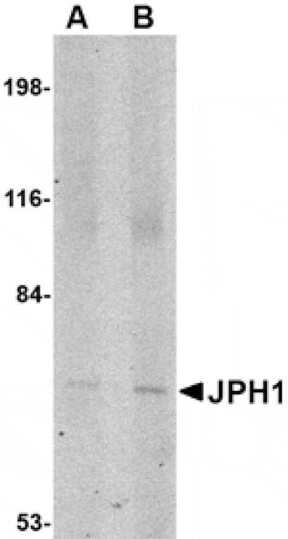 Western blot - JPH1 Antibody from Signalway Antibody (24793) - Antibodies.com