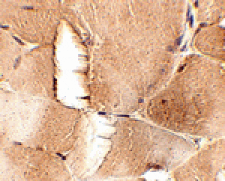 Immunohistochemistry - JPH1 Antibody from Signalway Antibody (24793) - Antibodies.com