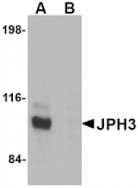 Western blot - JPH3 Antibody from Signalway Antibody (24795) - Antibodies.com