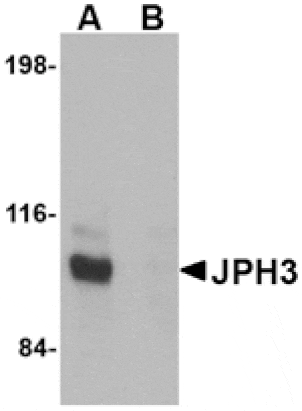 Western blot - JPH3 Antibody from Signalway Antibody (24795) - Antibodies.com