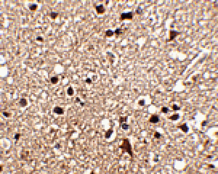 Immunohistochemistry - JPH3 Antibody from Signalway Antibody (24795) - Antibodies.com
