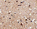 Immunohistochemistry - JPH3 Antibody from Signalway Antibody (24795) - Antibodies.com