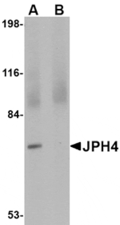 Western blot - JPH4 Antibody from Signalway Antibody (24796) - Antibodies.com