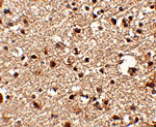 Immunohistochemistry - JPH4 Antibody from Signalway Antibody (24796) - Antibodies.com