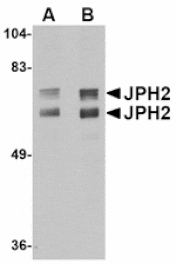 Western blot - JPH2 Antibody from Signalway Antibody (24798) - Antibodies.com