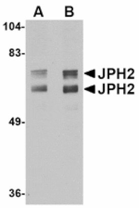 Western blot - JPH2 Antibody from Signalway Antibody (24798) - Antibodies.com