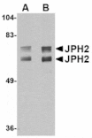 Western blot - JPH2 Antibody from Signalway Antibody (24798) - Antibodies.com