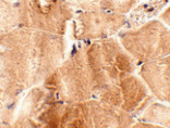 Immunohistochemistry - JPH2 Antibody from Signalway Antibody (24798) - Antibodies.com