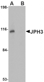 Western blot - JPH3 Antibody from Signalway Antibody (24799) - Antibodies.com