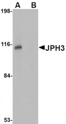 Western blot - JPH3 Antibody from Signalway Antibody (24799) - Antibodies.com