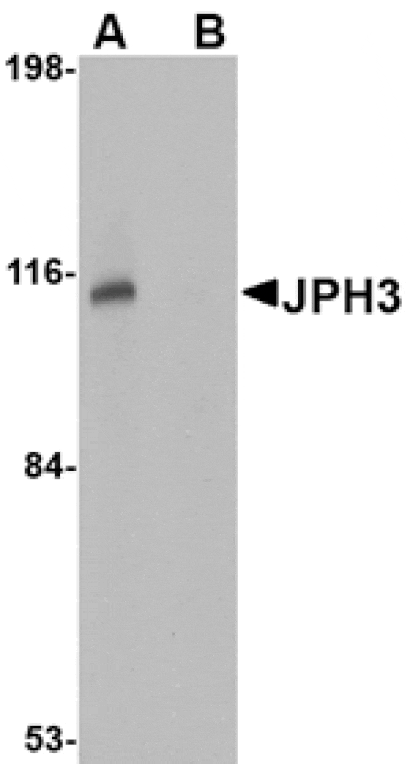 Western blot - JPH3 Antibody from Signalway Antibody (24799) - Antibodies.com