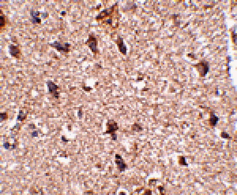 Immunohistochemistry - JPH3 Antibody from Signalway Antibody (24799) - Antibodies.com