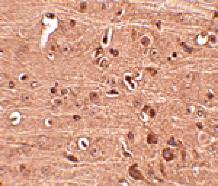 Immunohistochemistry - Gle1 Antibody from Signalway Antibody (24813) - Antibodies.com