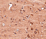 Immunohistochemistry - Gle1 Antibody from Signalway Antibody (24813) - Antibodies.com