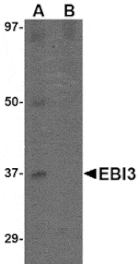 Western blot - EBI3 Antibody from Signalway Antibody (24814) - Antibodies.com