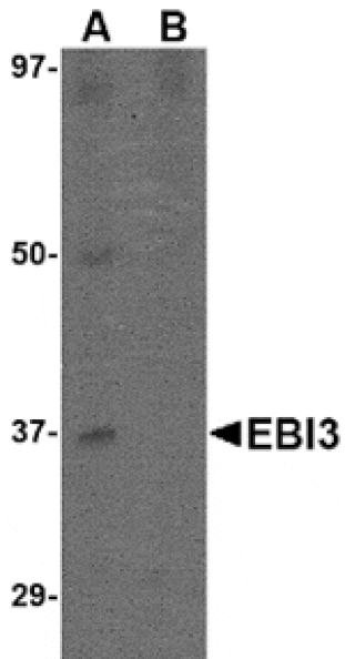 Western blot - EBI3 Antibody from Signalway Antibody (24814) - Antibodies.com