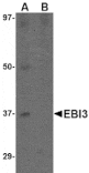 Western blot - EBI3 Antibody from Signalway Antibody (24814) - Antibodies.com