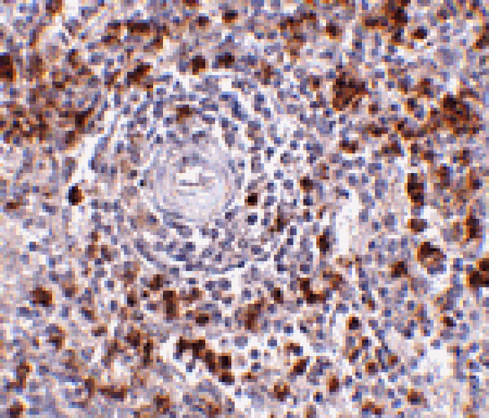 Immunohistochemistry - EBI3 Antibody from Signalway Antibody (24814) - Antibodies.com
