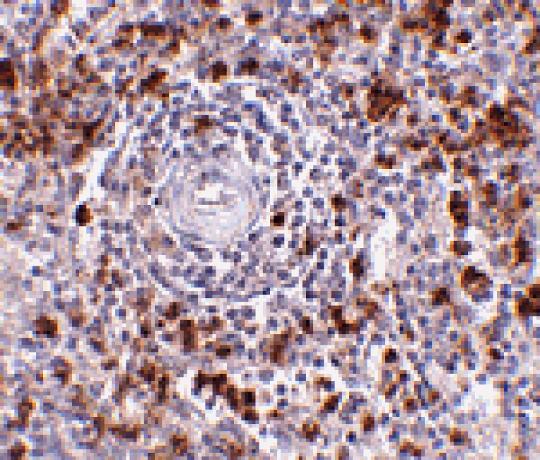 Immunohistochemistry - EBI3 Antibody from Signalway Antibody (24814) - Antibodies.com