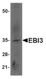 Western blot - EBI3 Antibody from Signalway Antibody (24818) - Antibodies.com