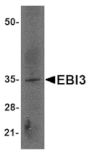 Western blot - EBI3 Antibody from Signalway Antibody (24818) - Antibodies.com