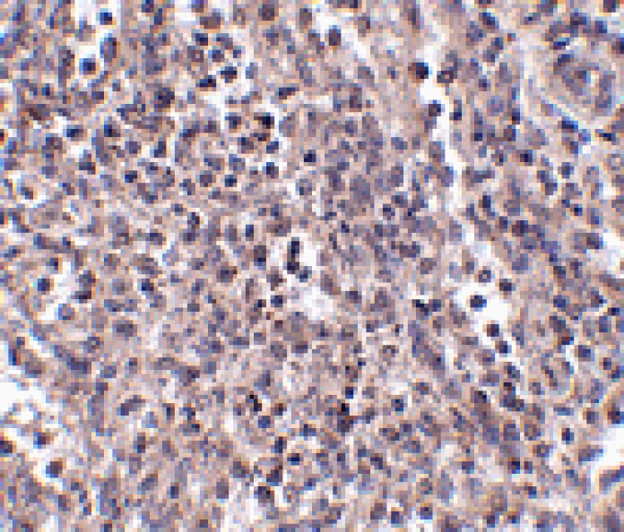 Immunohistochemistry - EBI3 Antibody from Signalway Antibody (24818) - Antibodies.com