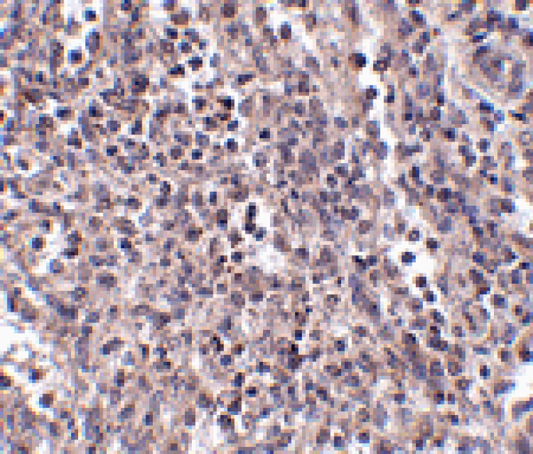 Immunohistochemistry - EBI3 Antibody from Signalway Antibody (24818) - Antibodies.com