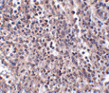 Immunohistochemistry - EBI3 Antibody from Signalway Antibody (24818) - Antibodies.com