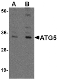 Western blot - ATG5 Antibody from Signalway Antibody (24840) - Antibodies.com