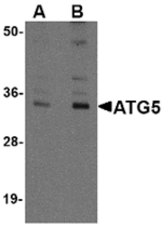 Western blot - ATG5 Antibody from Signalway Antibody (24840) - Antibodies.com