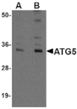 Western blot - ATG5 Antibody from Signalway Antibody (24840) - Antibodies.com