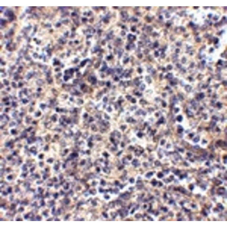 Immunohistochemistry - ATG5 Antibody from Signalway Antibody (24840) - Antibodies.com