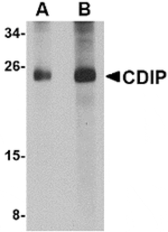 Western blot - CDIP Antibody from Signalway Antibody (24844) - Antibodies.com