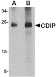 Western blot - CDIP Antibody from Signalway Antibody (24844) - Antibodies.com