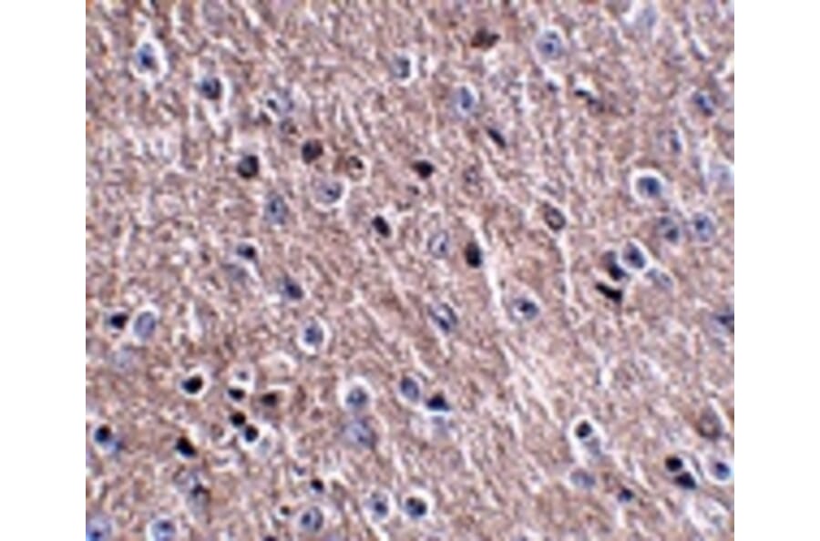 Immunohistochemistry - CDIP Antibody from Signalway Antibody (24844) - Antibodies.com