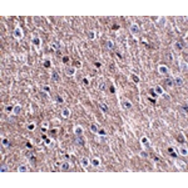 Immunohistochemistry - CDIP Antibody from Signalway Antibody (24844) - Antibodies.com