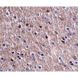 Immunohistochemistry - CDIP Antibody from Signalway Antibody (24844) - Antibodies.com
