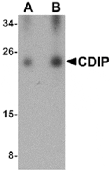 Western blot - CDIP Antibody from Signalway Antibody (24848) - Antibodies.com
