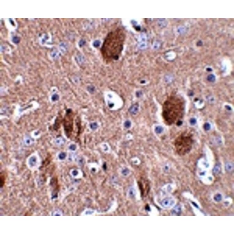 Immunohistochemistry - CDIP Antibody from Signalway Antibody (24848) - Antibodies.com