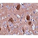 Immunohistochemistry - CDIP Antibody from Signalway Antibody (24848) - Antibodies.com