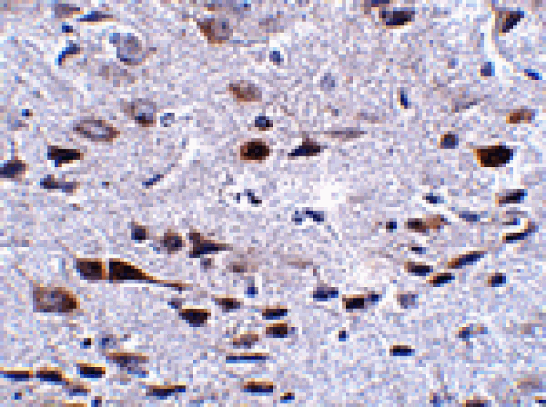 Immunohistochemistry - Bora Antibody from Signalway Antibody (24866) - Antibodies.com