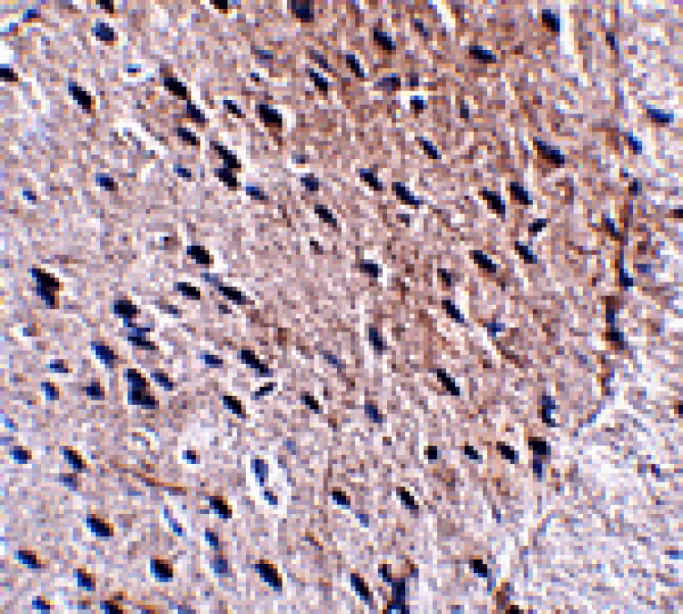 Immunohistochemistry - Bora Antibody from Signalway Antibody (24871) - Antibodies.com