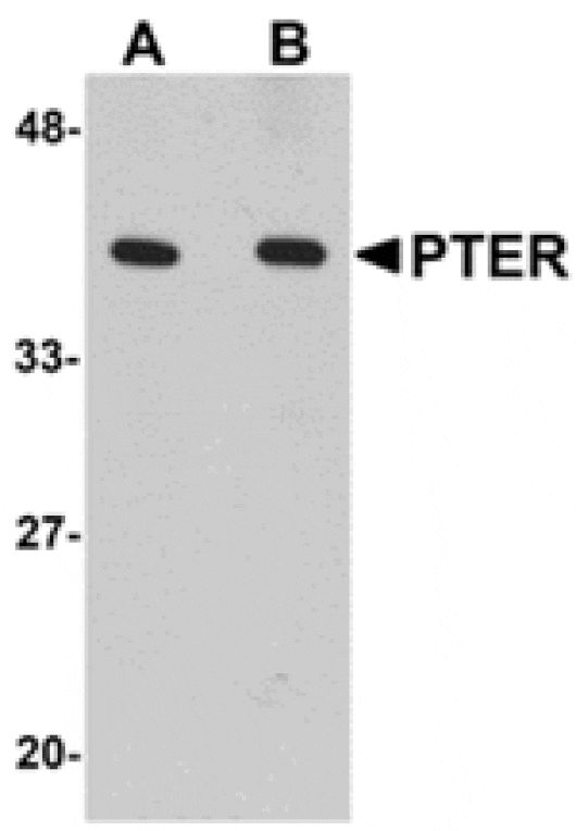 Western blot - PTER Antibody from Signalway Antibody (24898) - Antibodies.com